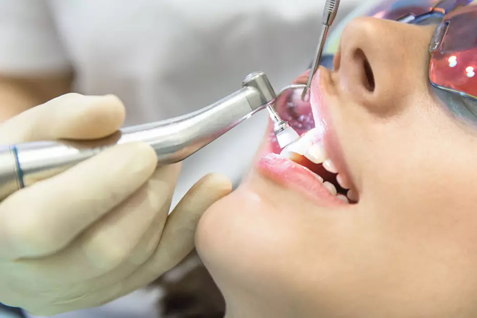 Professional Teeth Cleaning